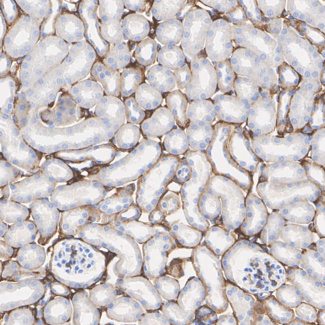 CD49a Antibody in Immunohistochemistry (Paraffin) (IHC (P))