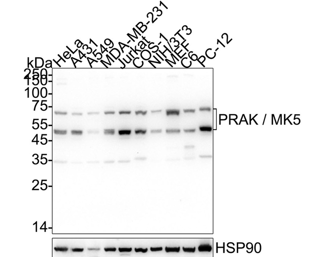 PRAK Antibody in Western Blot (WB)