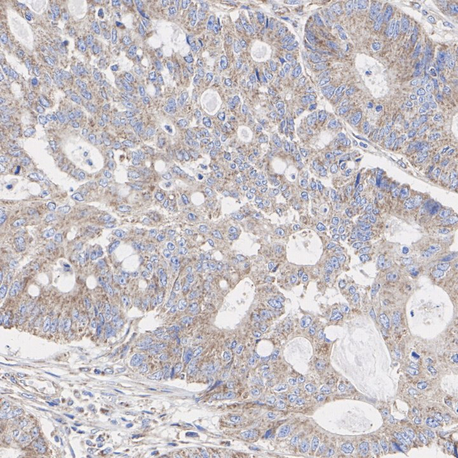 NDUFA9 Antibody in Immunohistochemistry (Paraffin) (IHC (P))