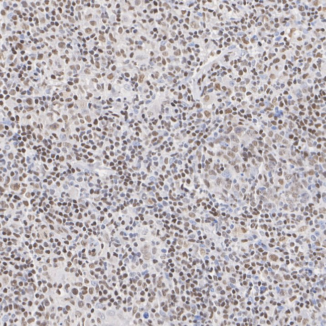 FLI1 Antibody in Immunohistochemistry (Paraffin) (IHC (P))