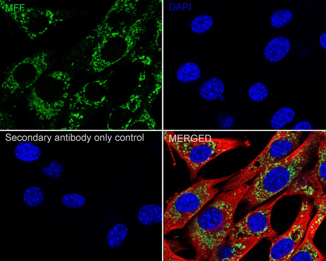 C2orf33 Antibody in Immunocytochemistry (ICC/IF)