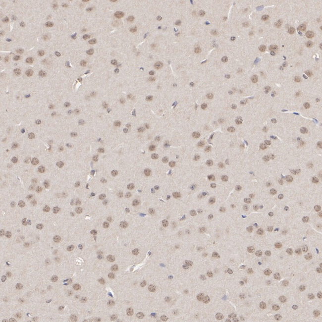 HUWE1 Antibody in Immunohistochemistry (Paraffin) (IHC (P))