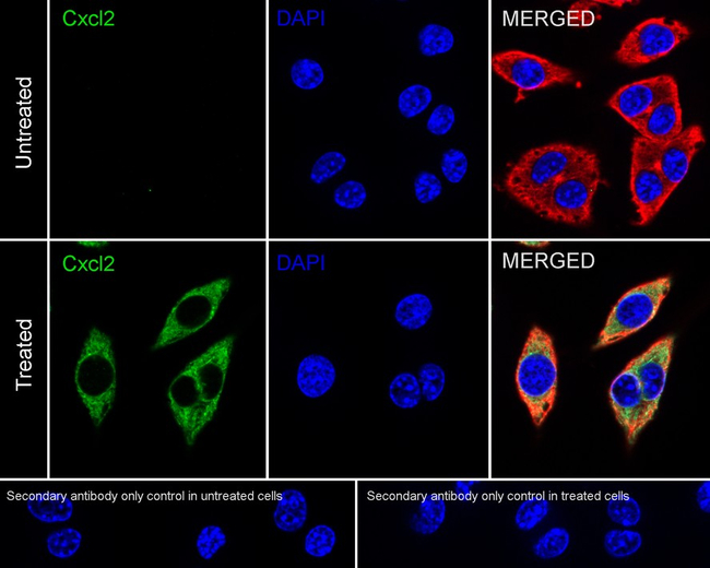 CXCL2 Antibody in Immunocytochemistry (ICC/IF)