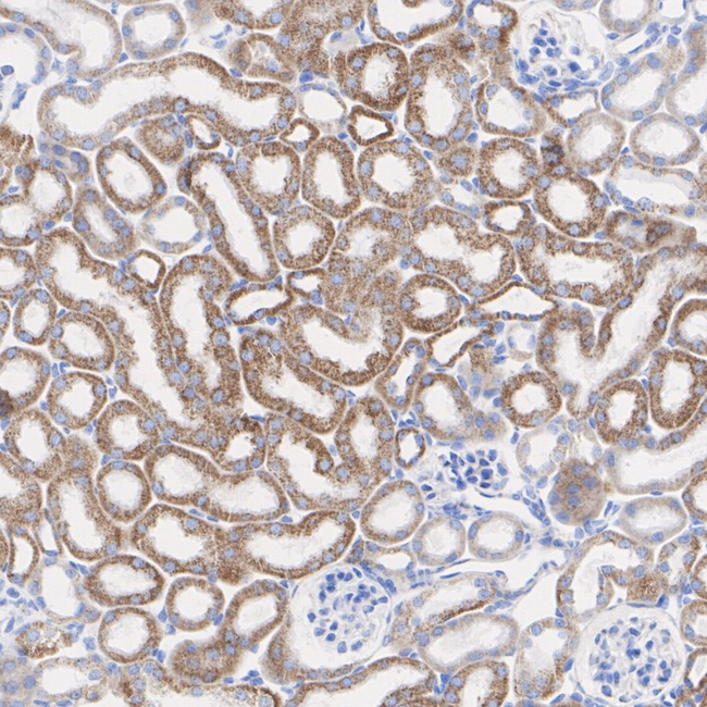 NDUFS1 Antibody in Immunohistochemistry (Paraffin) (IHC (P))