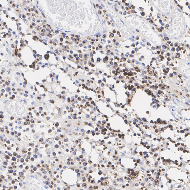 Granzyme B Antibody in Immunohistochemistry (Paraffin) (IHC (P))