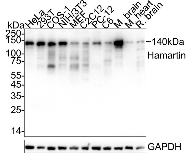TSC1 Antibody in Western Blot (WB)