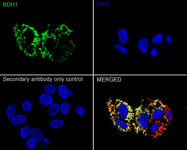 BDH1 Antibody in Immunocytochemistry (ICC/IF)