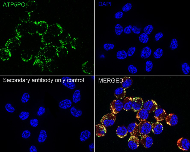 ATP Synthase O Antibody in Immunocytochemistry (ICC/IF)