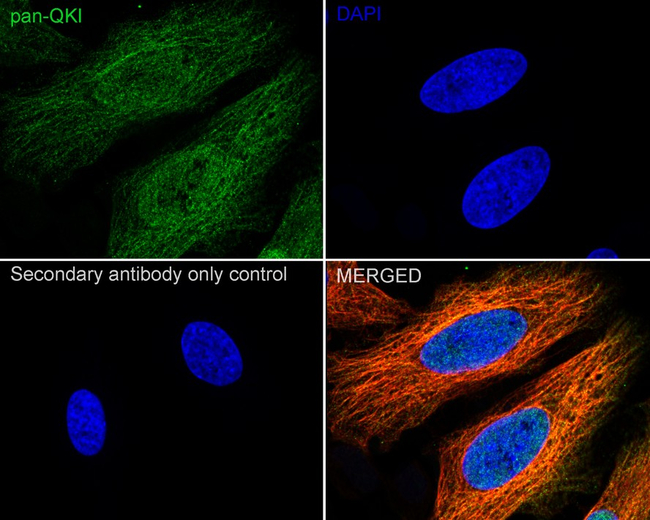 QKI Antibody in Immunocytochemistry (ICC/IF)