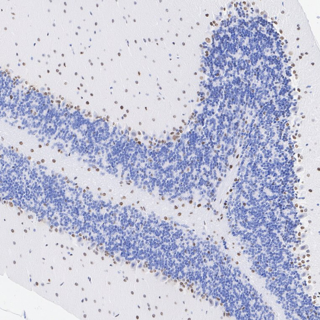 QKI-5 Antibody in Immunohistochemistry (Paraffin) (IHC (P))
