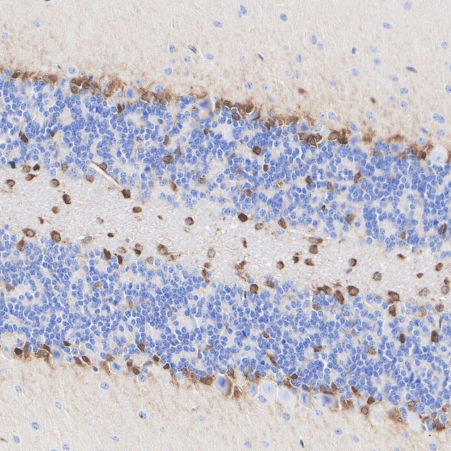 QKI-6 Antibody in Immunohistochemistry (Paraffin) (IHC (P))