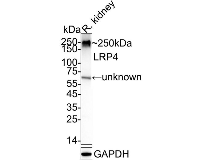 LRP4 Antibody in Western Blot (WB)