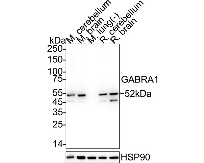 GABRA1 Antibody in Western Blot (WB)