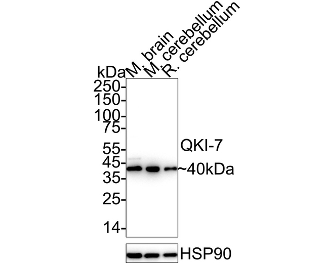 QKI-7 Antibody in Western Blot (WB)