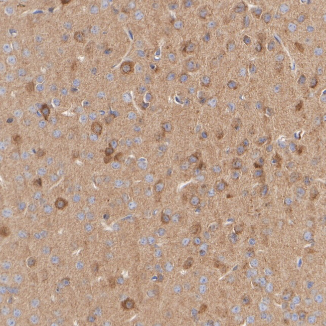 LIMK1 Antibody in Immunohistochemistry (Paraffin) (IHC (P))