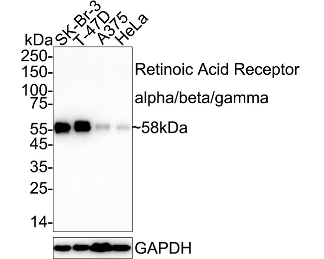 RARA/RARB/RARG Antibody in Western Blot (WB)