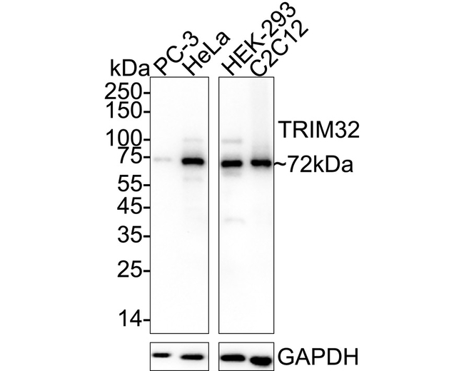 TRIM32 Antibody in Western Blot (WB)