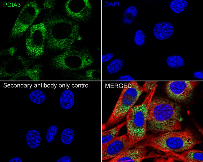 ERp57 Antibody in Immunocytochemistry (ICC/IF)