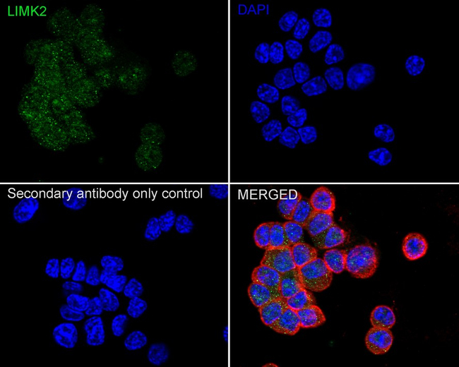 LIMK2 Antibody in Immunocytochemistry (ICC/IF)