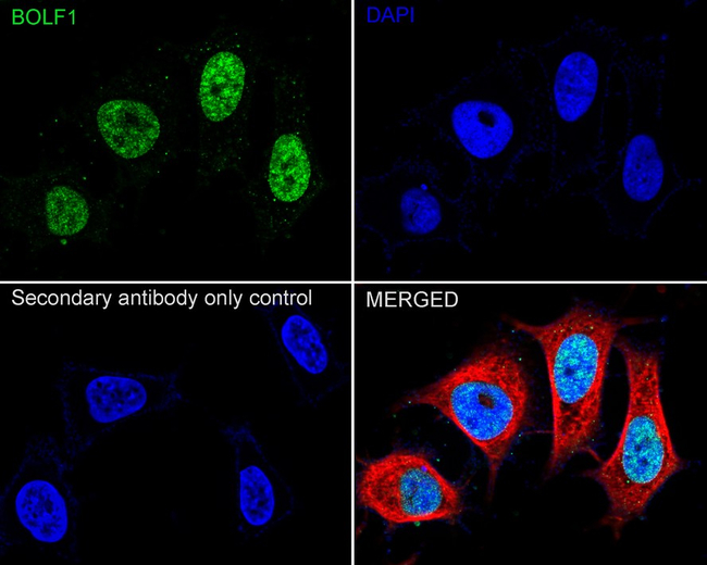 Epstein Barr Virus BOLF1 Antibody in Immunocytochemistry (ICC/IF)