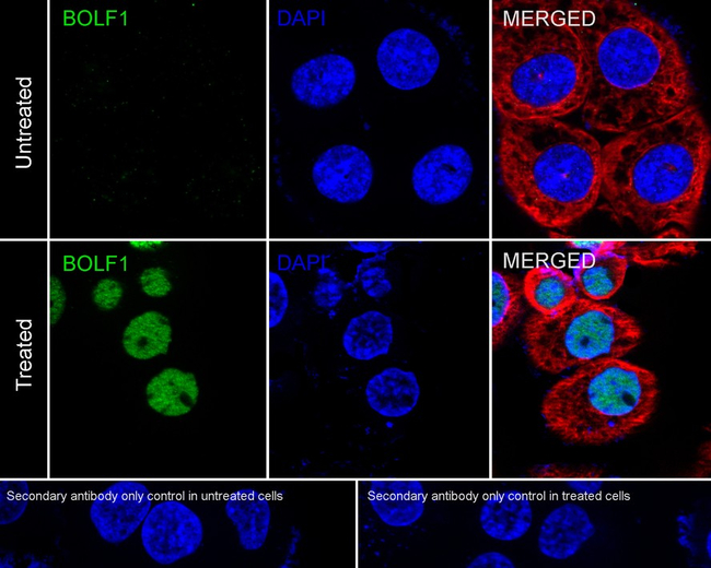 Epstein Barr Virus BOLF1 Antibody in Immunocytochemistry (ICC/IF)