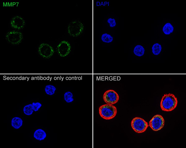 MMP7 Antibody in Immunocytochemistry (ICC/IF)