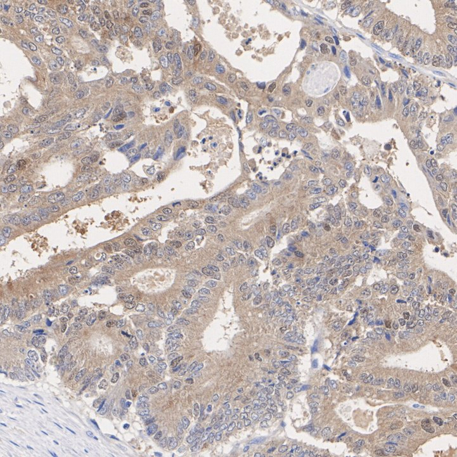 PSAT1 Antibody in Immunohistochemistry (Paraffin) (IHC (P))