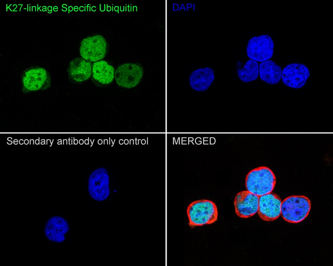 Ubiquitin (linkage specific K27) Antibody in Immunocytochemistry (ICC/IF)