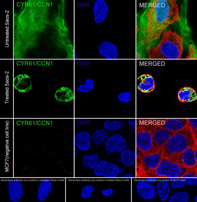 CYR61 Antibody in Immunocytochemistry (ICC/IF)