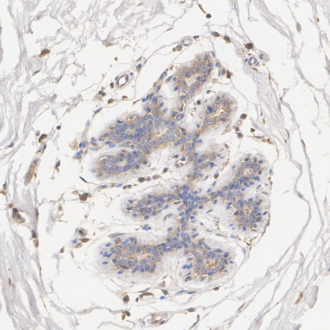 COMMD10 Antibody in Immunohistochemistry (Paraffin) (IHC (P))