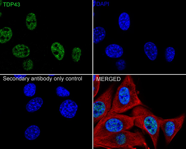 TDP-43 Antibody in Immunocytochemistry (ICC/IF)