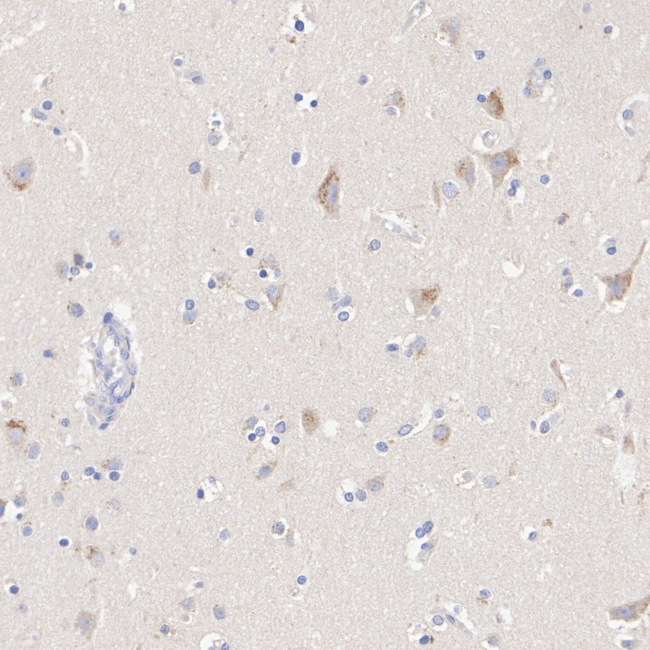SLC11A2 Antibody in Immunohistochemistry (Paraffin) (IHC (P))