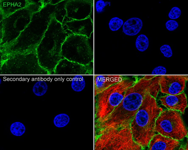 EphA2 Antibody in Immunocytochemistry (ICC/IF)