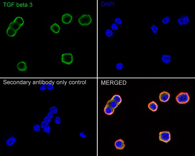 TGF beta-3 Antibody in Immunocytochemistry (ICC/IF)