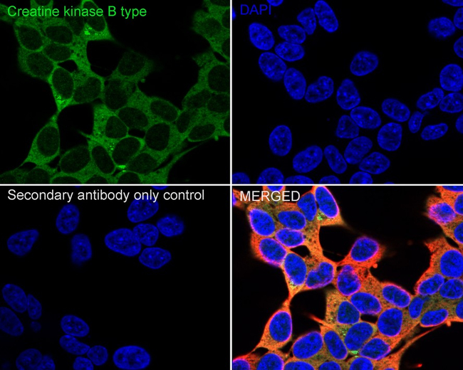 Creatine Kinase BB Antibody in Immunocytochemistry (ICC/IF)