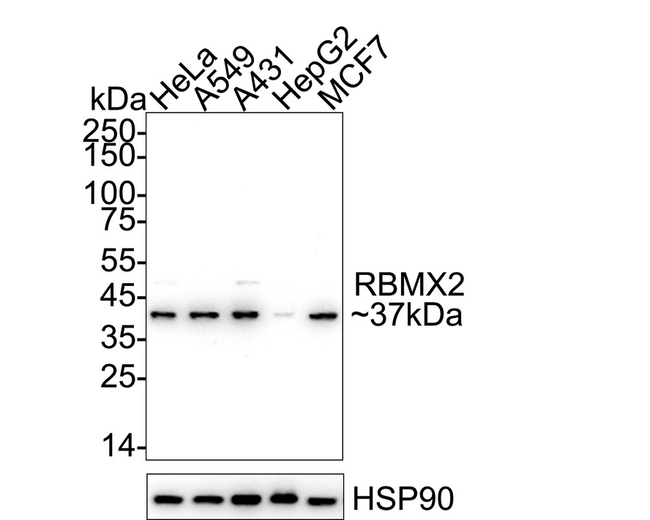 RBMX2 Antibody in Western Blot (WB)
