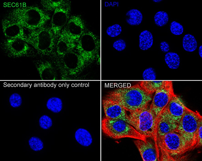 SEC61B Antibody in Immunocytochemistry (ICC/IF)