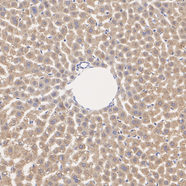 CCS Antibody in Immunohistochemistry (Paraffin) (IHC (P))
