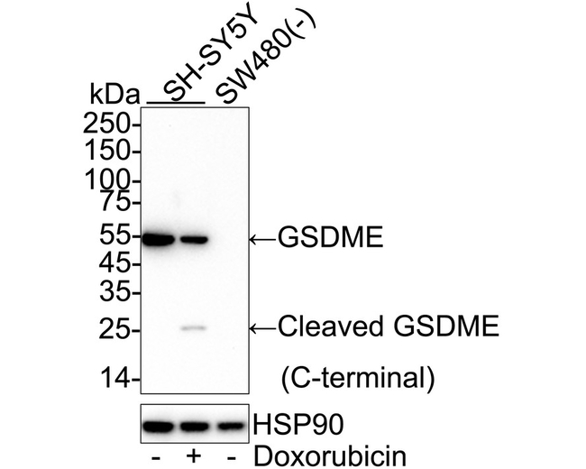 DFNA5 Antibody in Western Blot (WB)
