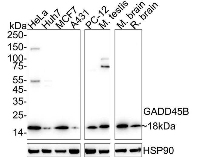 GADD45B Antibody in Western Blot (WB)