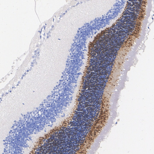 PDC Antibody in Immunohistochemistry (Paraffin) (IHC (P))