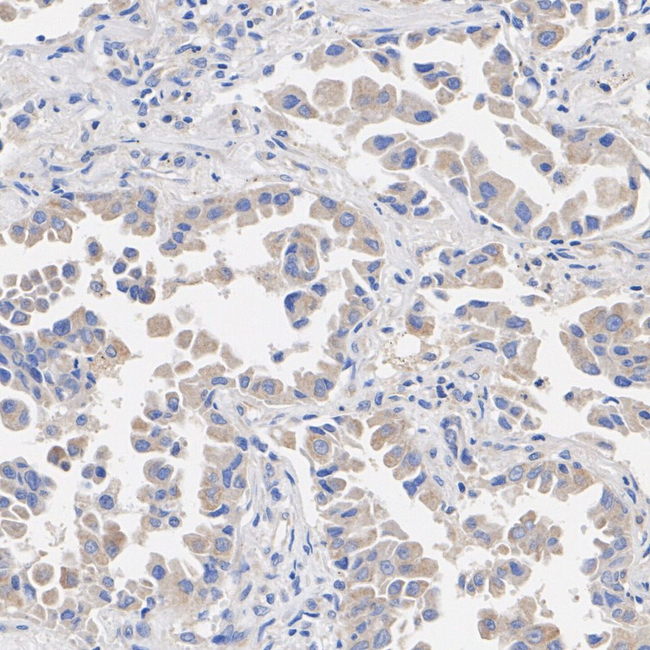 MMP1 Antibody in Immunohistochemistry (Paraffin) (IHC (P))