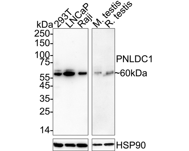 PNLDC1 Antibody in Western Blot (WB)