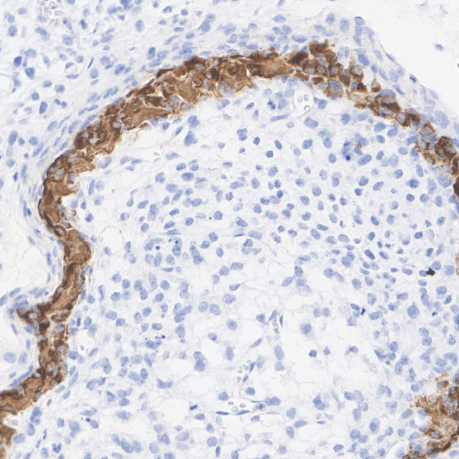 Bone SialoProtein 2 Antibody in Immunohistochemistry (Paraffin) (IHC (P))