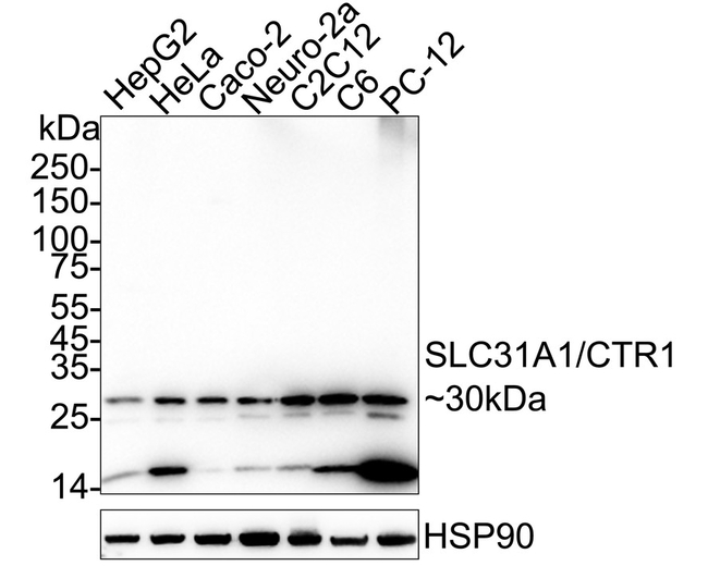 CTR1 Antibody in Western Blot (WB)