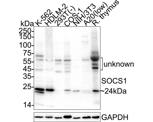 SOCS1 Antibody in Western Blot (WB)