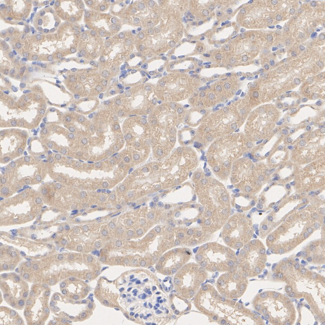 DHODH Antibody in Immunohistochemistry (Paraffin) (IHC (P))