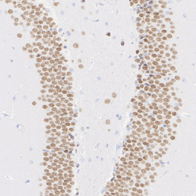 MYT1L Antibody in Immunohistochemistry (Paraffin) (IHC (P))