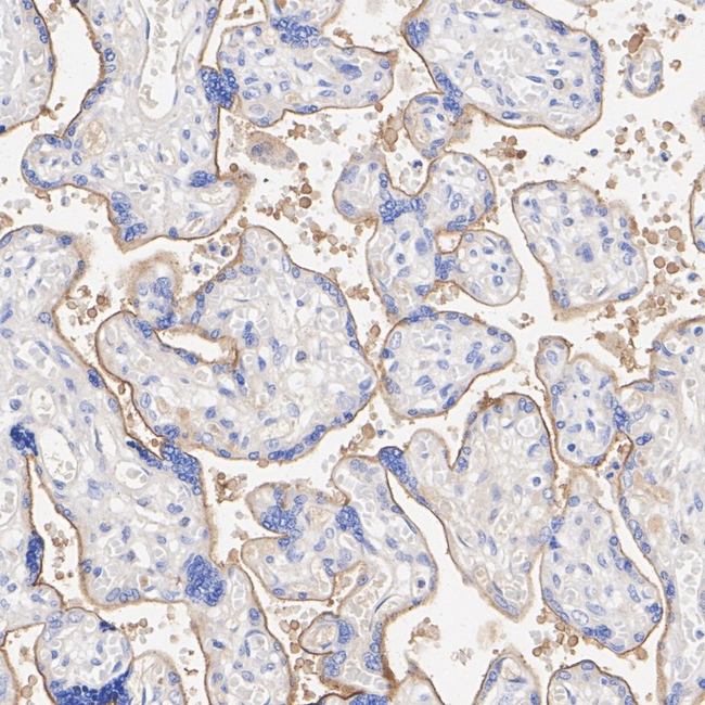 Nectin 4 Antibody in Immunohistochemistry (Paraffin) (IHC (P))