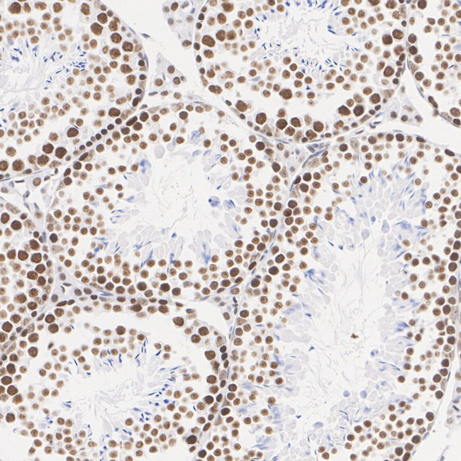 SSRP1 Antibody in Immunohistochemistry (Paraffin) (IHC (P))